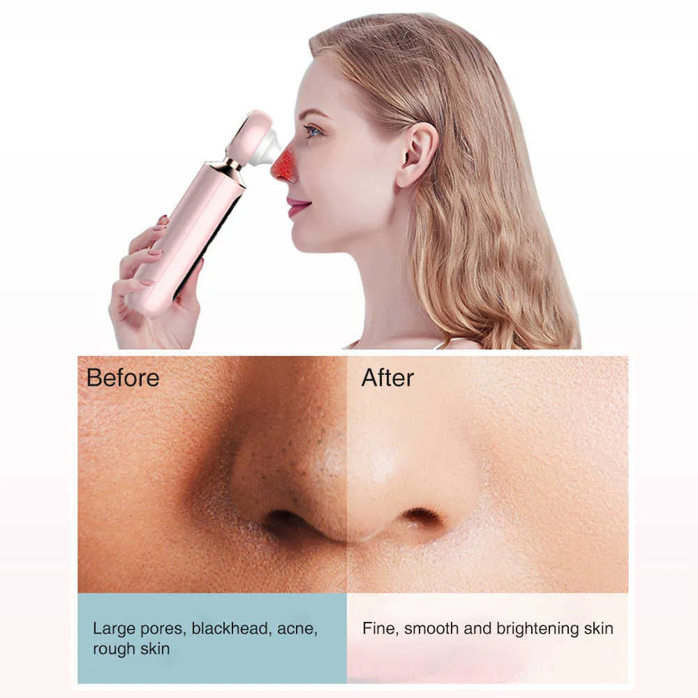 ARABELLA™ Blackhead Suction Machine