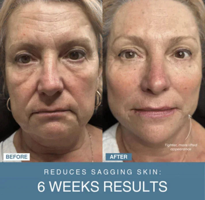 ARABELLA™ 7-in-1 LED Anti-Aging/Wrinkle Apparatus