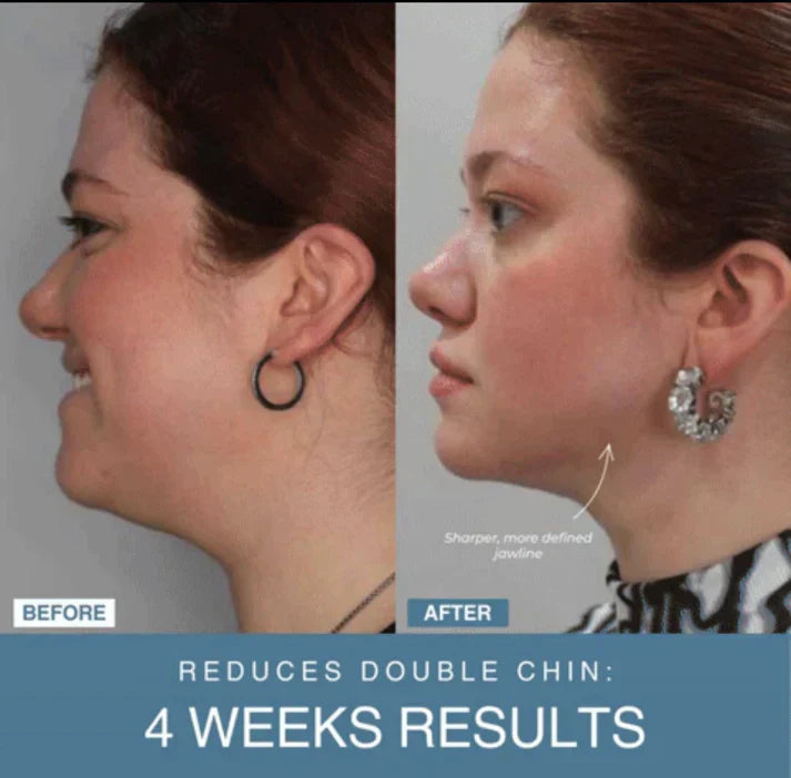 ARABELLA™ 7-in-1 LED Anti-Aging/Wrinkle Apparatus