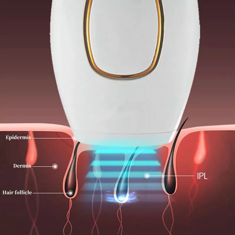 ARABELLA™ IPL Laser Hair Removal – جهاز إزالة الشعر بالليزر IPL